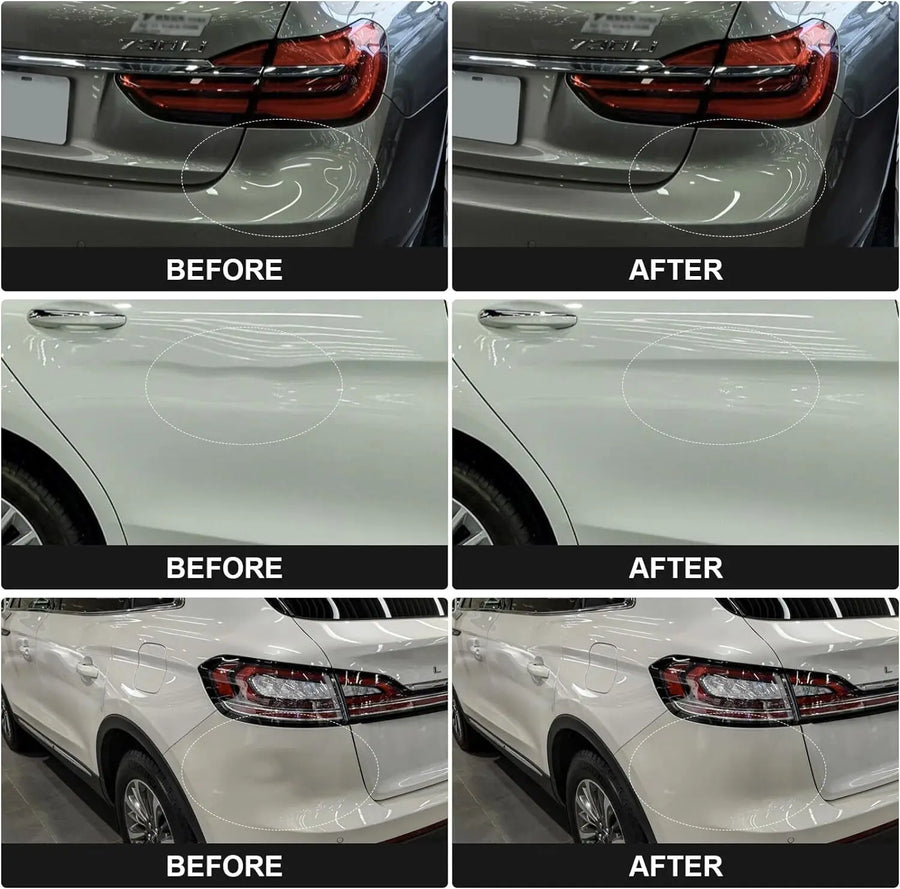 Paintless Dent Repair Puller Kit with Suction Cups