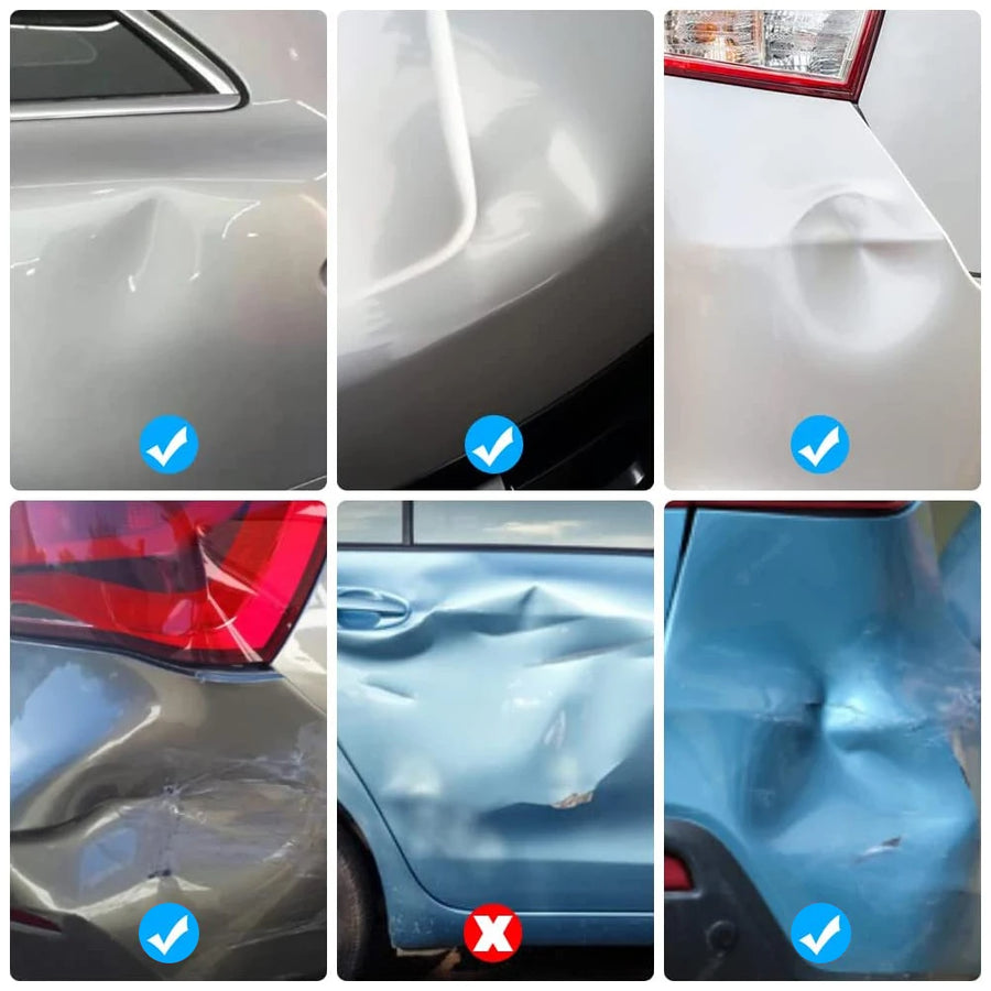 Paintless Dent Repair Puller Kit with Suction Cups