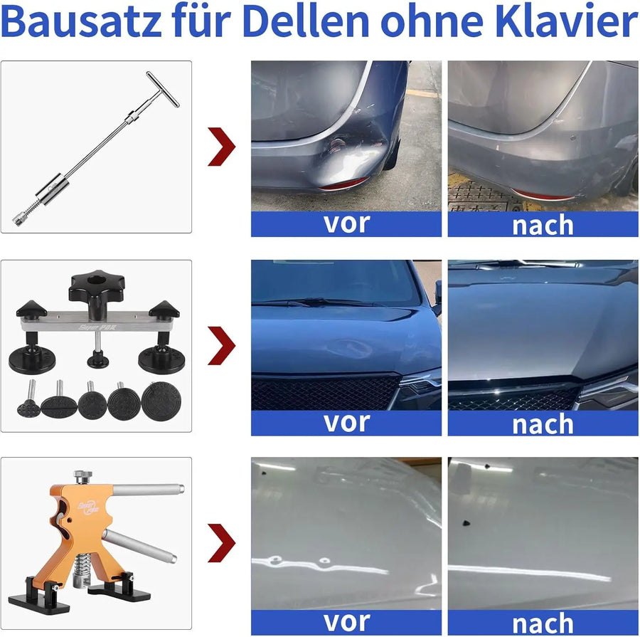 Paintless Dent Repair Puller Kit with Suction Cups